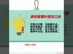tipo CE ISO13485 de la mariposa de los catéteres intravenosos disponibles verdes 18G